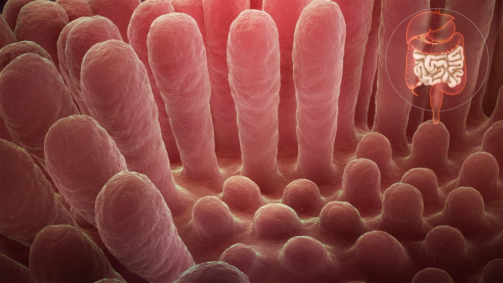Inflammed mucous layer of the intestinal villi depicting Celiac disease